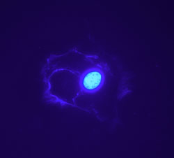 fertilizare in vitro