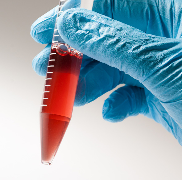 descoperire medicala - sange artificial creat de romani