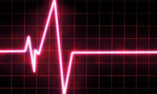Primul ajutor in caz de infarct miocardic