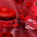 Sindrom antifosfolipidic - risc de infarct si accident vascular
