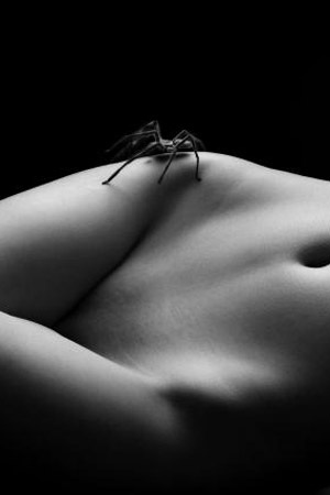 Candidoza
Candidoza vaginala este o vaginita micotica (cauzata de
