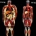 Corpuri scanate: O femeie de 114 kg vs. o femeie de 54 kg