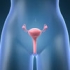 Tot ce trebuie sa stii despre HPV si cancer de col uterin