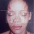 Rihanna, desfigurata de iubit