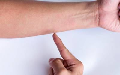 Degetul de declanşare, Umflarea articulației degetului după o tăietură