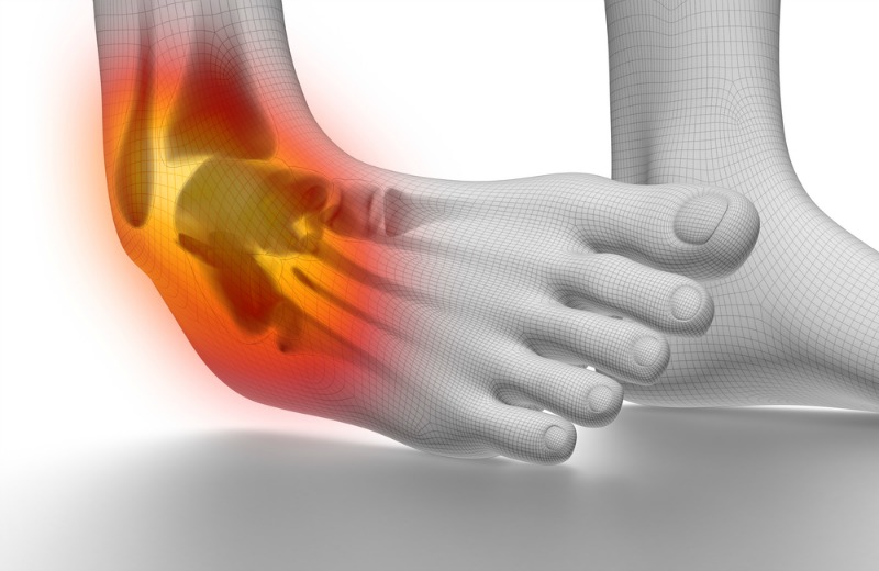 Ministerul Afacerilor Interne afectează ligamentele de gleznă laba piciorului umflata si rosie